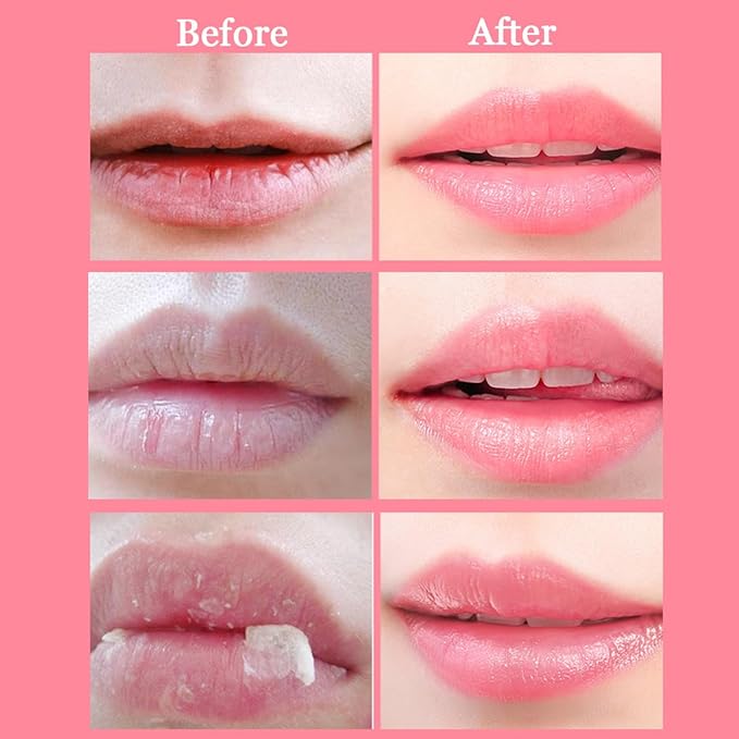 2 Pcs Bee Lip Balm Honey Pot,Honey & Strawberry Lip Mask Propolis Moisturizing Lip Balm with Stick,Prevention Dry and Cracked Lip Scrubs,Exfoliator Lip Wrinkle Skin Care Products