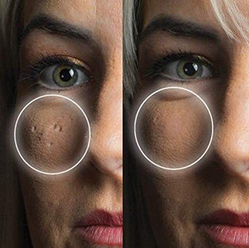 What to Do When Your Skin Suddenly Breaks Out: A Detailed Guide