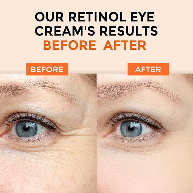 The Truth About Retinol and How to Use It Safely