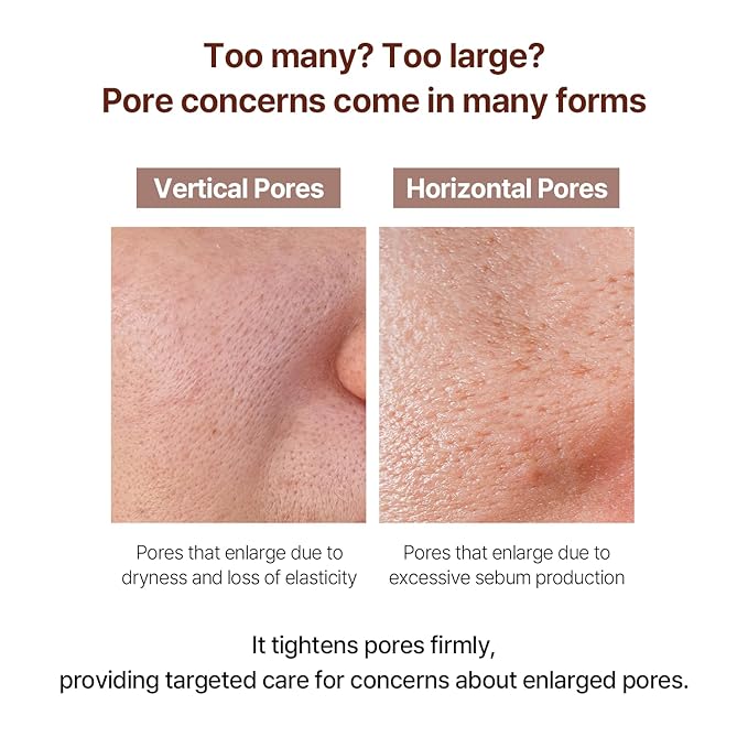 Ingredients Oily Skin Types Should Be Careful With