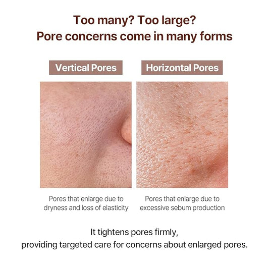 Ingredients Oily Skin Types Should Be Careful With