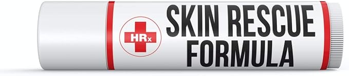 Skin Rescue Formula (Herp Stop Discreet) Defense and Support for Clear Skin 100% Natural! Peppermint Oil, Shea Butter, Zinc, Tea Tree, Coconut Oil .5 oz