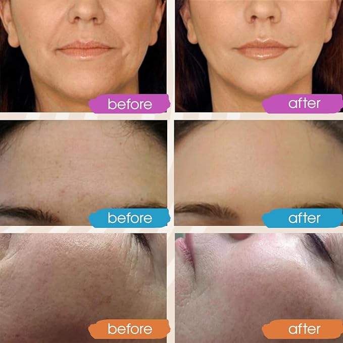 Retinol Serum for Face with Hyaluronic Acid, Retinol for Face Is Suitable for All Skin Types, Hydrating Serum Women and Men Plumps Youthful Appearance 2oz