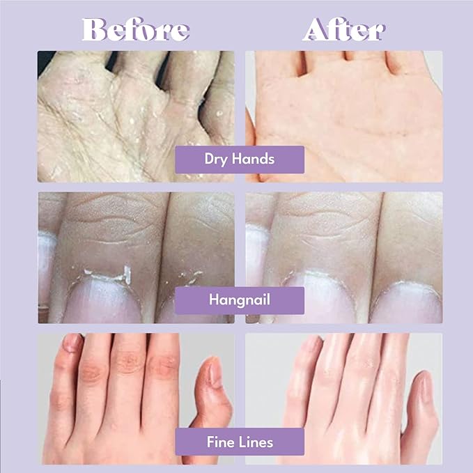 Catherine Muller Floral Hand Mask 8 Pairs, Moisturizing Gloves for Dry Hands with Elder Flower & CICA, Repairing and Nourishing Hand Care Treatment for Cracked, Rough, and Dry Skin