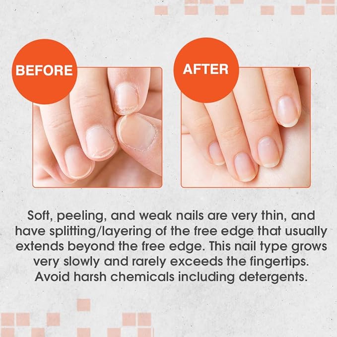 Nail Tek Intensive Therapy 2,