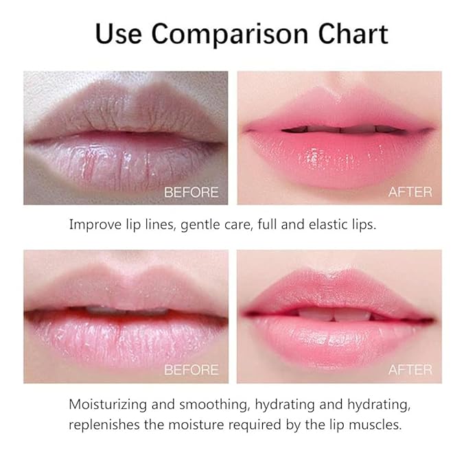 20Pcs Moisturizing/Plumping Lip Mask, Restores Moisture Mask for Dry Lips and Lines Overnight Care, Gel Treatment Masks  (Pink)