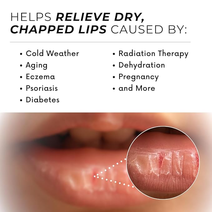 Natural Lip Balm For Very Dry Lips | Pack of 4 | Moisturizing Ghee, Shea Butter, Beeswax, Coconut Oil, & Jojoba Oil | Hydrating Lip Care For Chapped Lips, After Sun Care | Bioserene