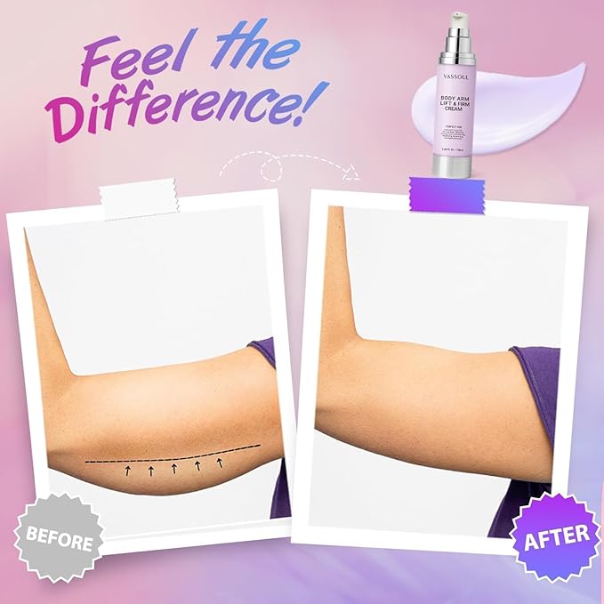 VASSOUL Lift and Firm Arm Cream : Skin Tightening Cream for Body - Firms Loose Skin, Reduces Cellulite on Arms, Thighs & Butt – 100ML