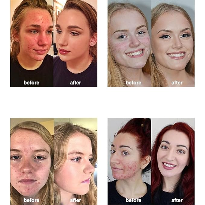 2 Pack PHOERA Foundation 104 Buff Beige Makeup,Full