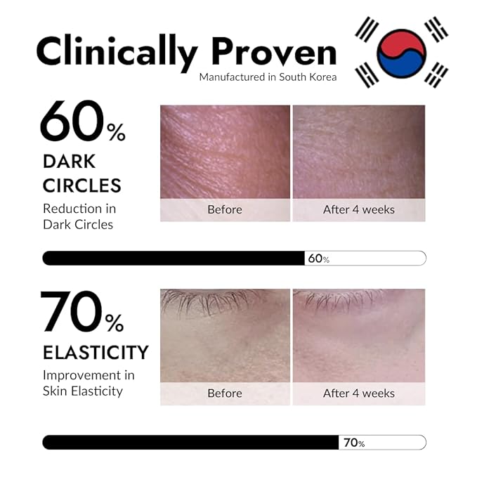 MIZON Under Eye Patches for Puffy Eyes & Dark Circles, 24K Gold & Snail Mucin, 60 Pcs – Anti-Wrinkle Collagen & Peptide Formula – Moisturizing Korean Eye Mask for Elasticity