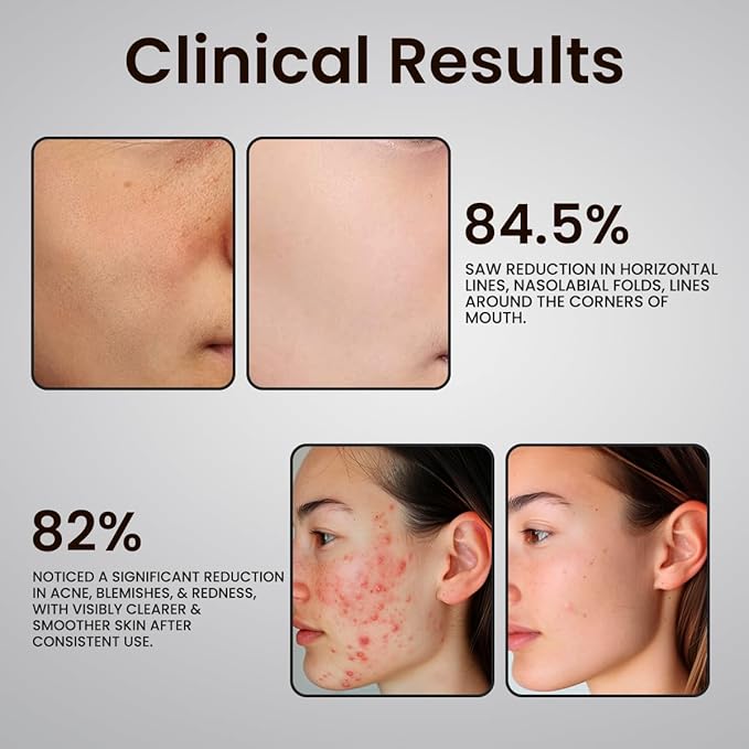 Glutathione Serum with 5+Peptides -20,000ppm Glutathione brightening 50X dark spot Serum for Face- Hyperpigmentation Serum, Anitoxidants B3,B5 C E Niacinamide fights Aging Signs [5 serum in 1]