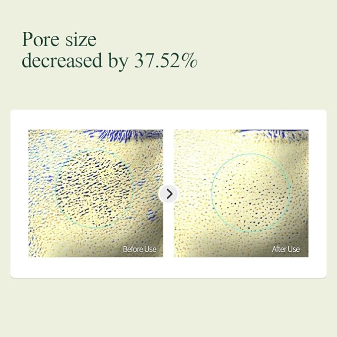 PYUNKANG YUL Calming Line Gift Box Set-Korean Facial Skin Care Essential for Daily Moisturizing with Toner, Serum, Cream, Safe on Acne Prone & Sensitive Skin, Vegan & Cruelty Free