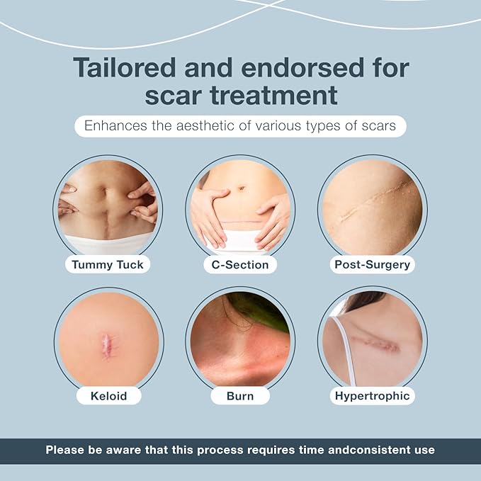 Silicone Scar Sheets, Scar Tape