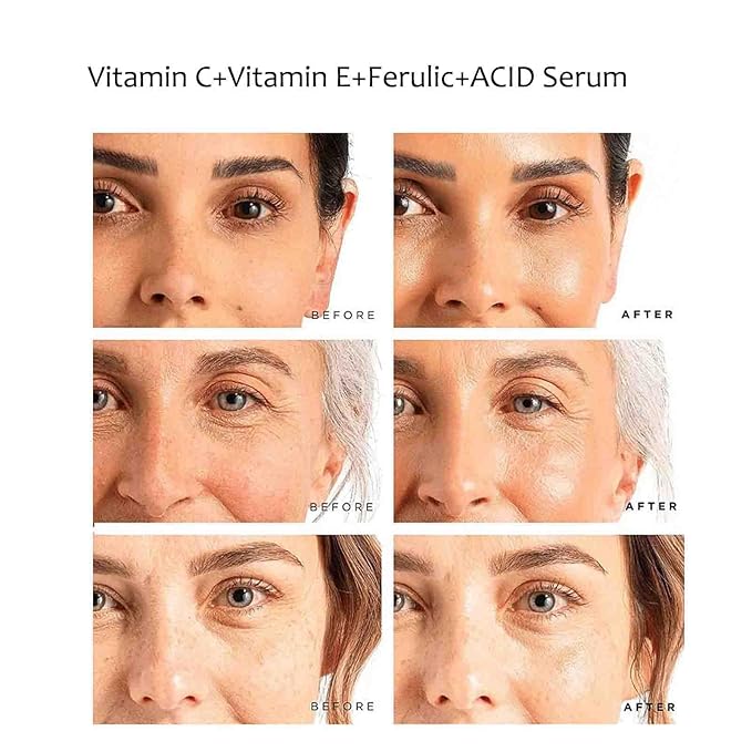 Vitamin C Face Serum Vitamin CE Serum with Ferulic Acid for Women Vitamin E and Ferulic Serum Skin Care - Vitamin C Serum for Face - Dark Spot Corrector, Anti Aging Face Care 1 Oz