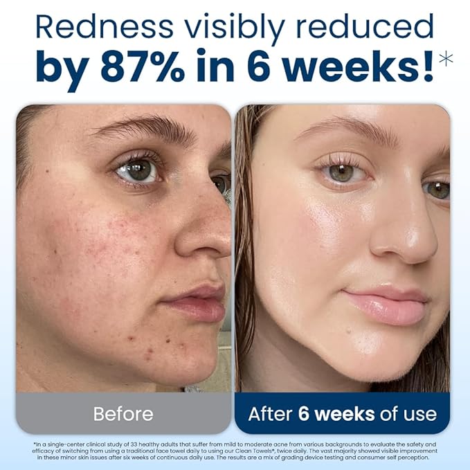 Clean Skin Club Clean Towels XL, USDA Certified 100‪%‬ Biobased Dermatologist Approved Disposable Face Towelette, Facial Washcloth, Makeup Remover Dry Wipes, Ultra Soft, 150 count, 3 pack