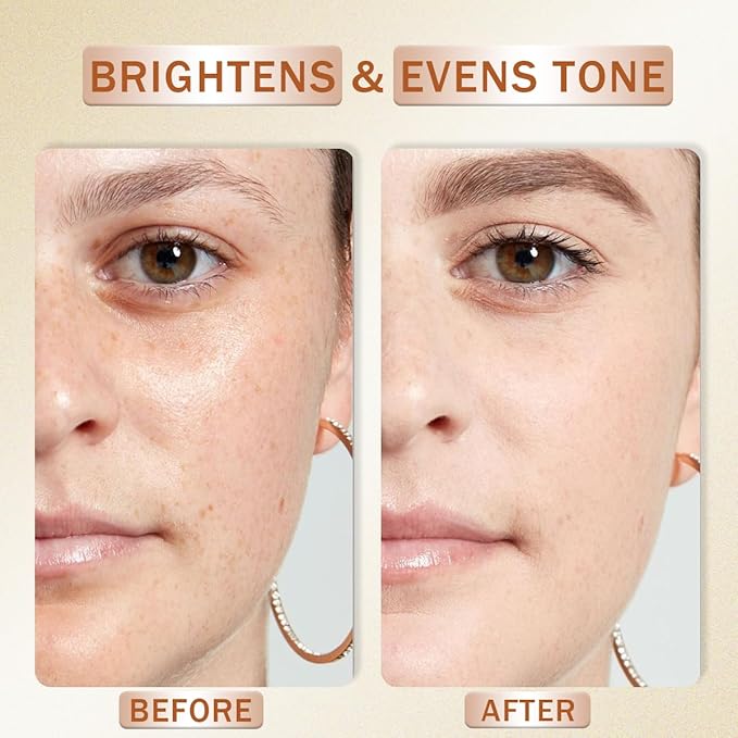 Vitamin C Serum for Face with Hyaluronic Acid, Boost Skin Collagen, Brightening, Antioxidant, Anti-Aging, Hydrate & Plump, Improve Appearance of Dark Spots, Tone, Fine Lines Facial Serum 30ml/1 fl oz