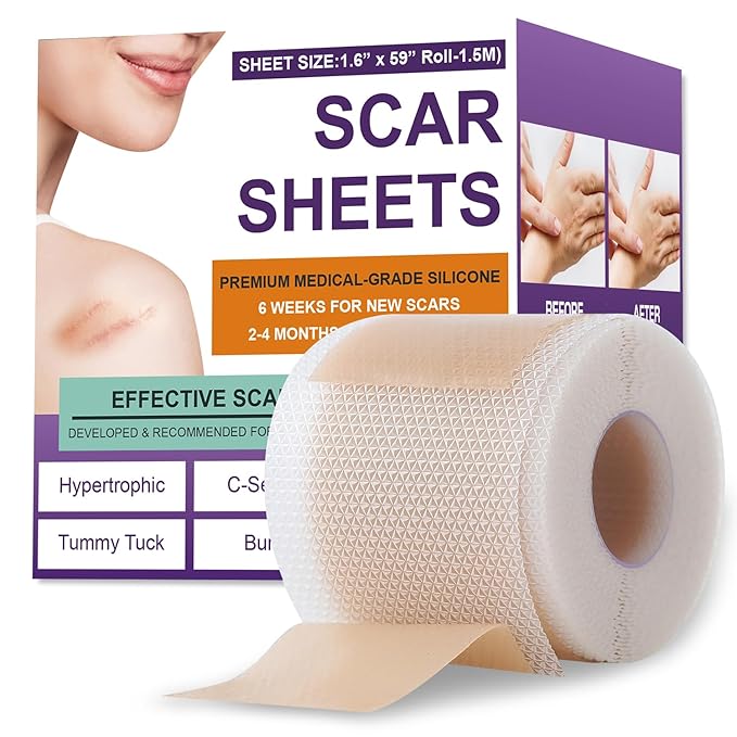 Silicone Scar Sheets,Silicone Scar Tape,Scar Tape