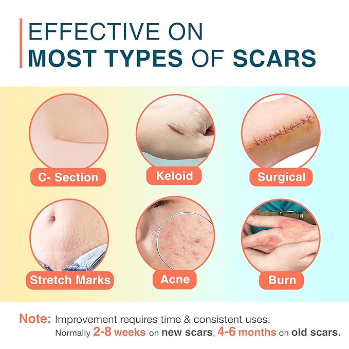 Silicone Scar Sheets, 1.5¡± x 156¡±