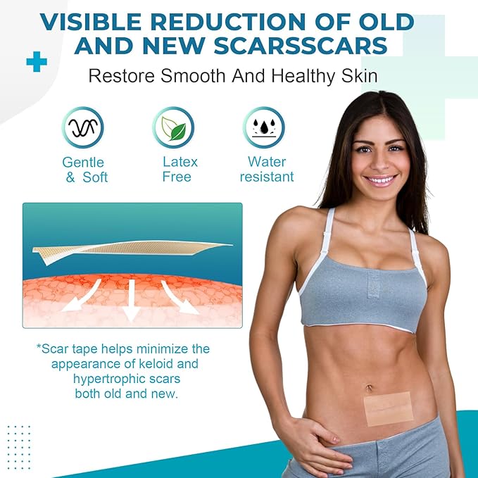 Silicone Scar Sheets, Silicone Scar Tape(1.6¡±x