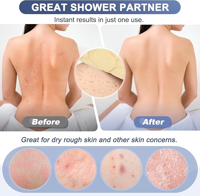 Exfoliating back scrubber with handles,