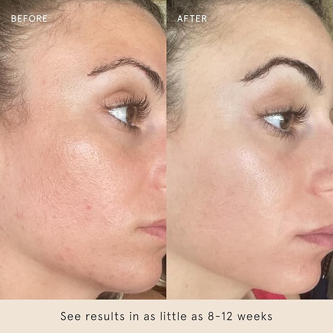 Barefaced Serum Duo - RetinAL & Liquid Gold to Hydrate, Even Skin Tone, & Reduce Signs of Aging