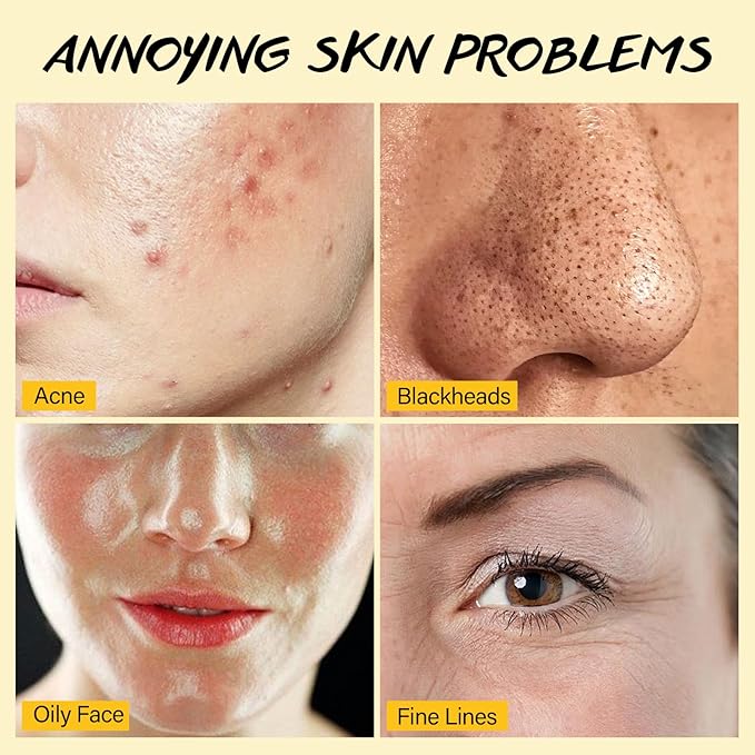 Lemon Face Scrub with Glycolic Acid Microdermabrasion Facial Scrub AHA Exfoliating for Women Men Safe Vegan Improves Acne Blackheads Soft Soothing without Irritation