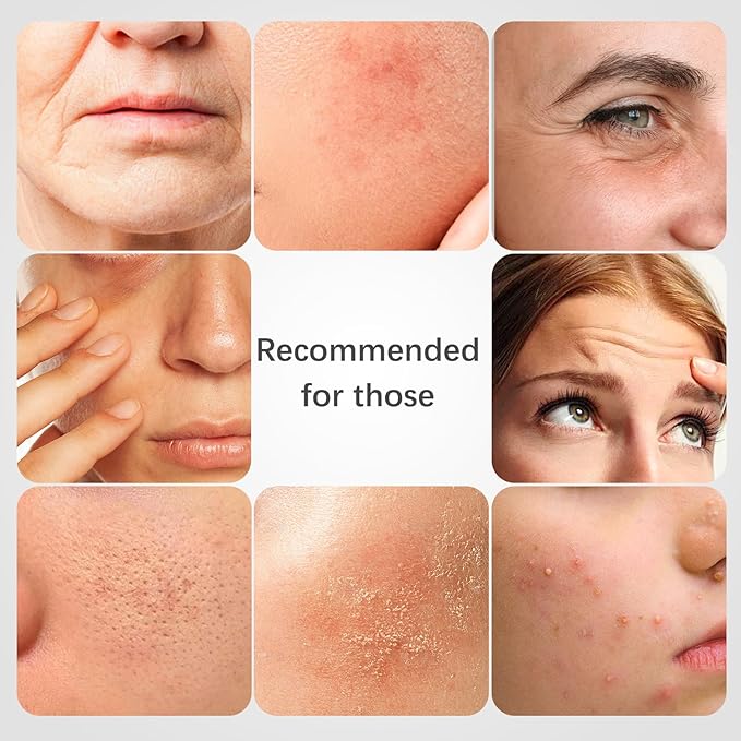 ISTON 4-in-1 Bio-Collagen Real Deep Mask Set -Plump Sagging Skin,Deep Hydration,Soothe & Repair,Nourish & Firm, Overnight Hydrogel Mask for All Skin Type