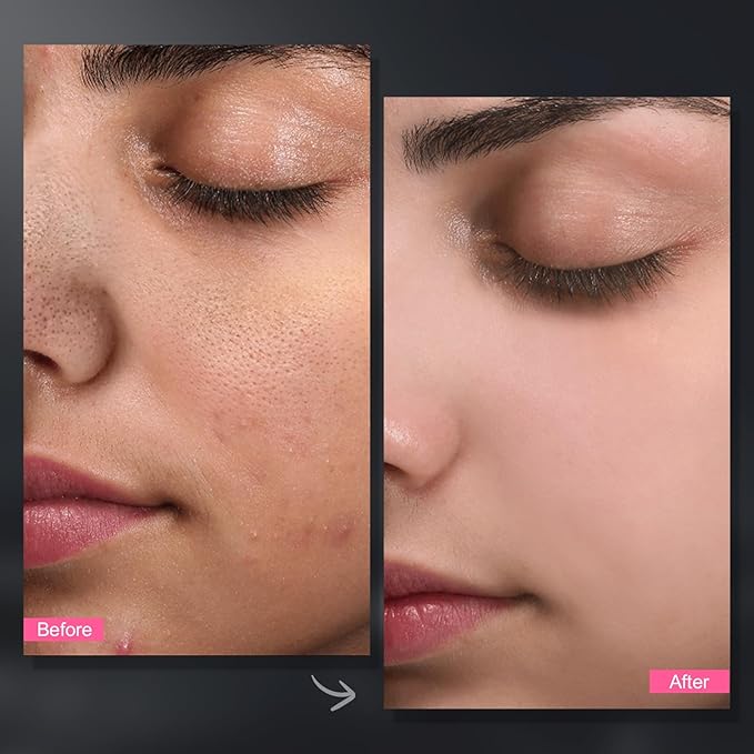 Carbonated Bubble Clay Mask -Exfoliation Face Mask | Detoxing Clay Mask for Blackhead Removal,Dull Skin,Skincare Facial Mask for Controlling Oil and Refining Pores,Mothers Day Gifts for Wife