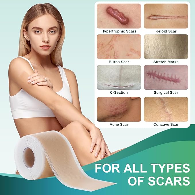 Medical Grade Silicone Scar Sheets, Silicone