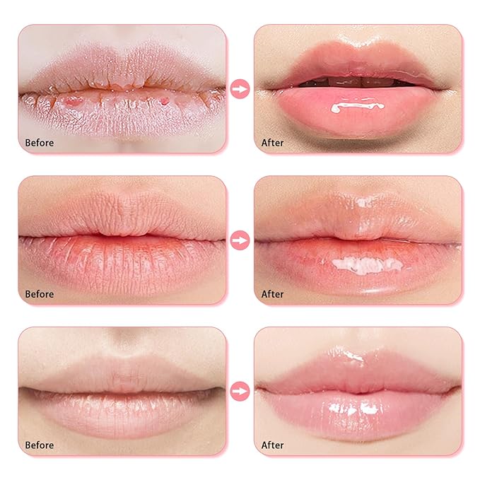 3 Pcs Bee Lip Balm Honey (Honey+Strawberry+Watermelon)