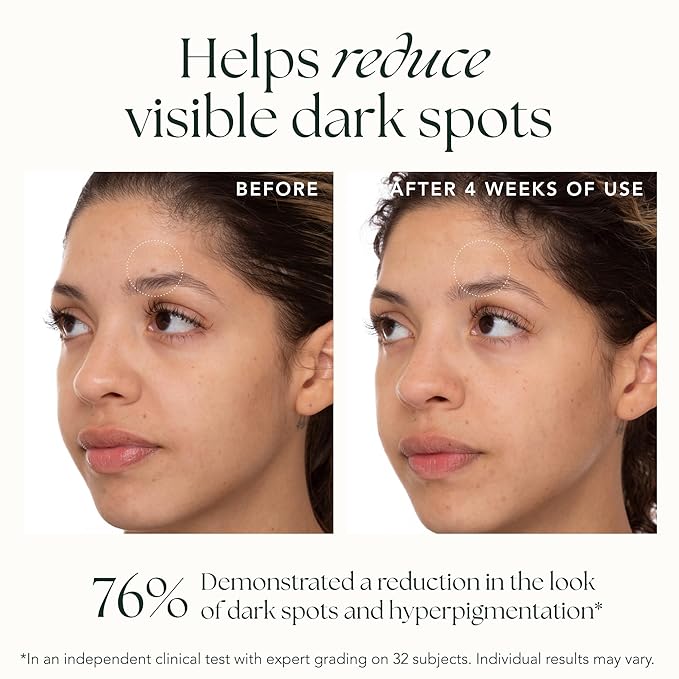 Brightening Saffron Serum - Discoloration Correcting Face Serum, Dark Spot Corrector, Vitamin C Alternative & Hyperpigmentation Treatment - Leaves Skin with a Healthy Glow (0.17 oz)