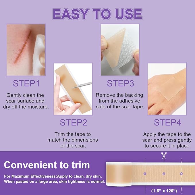 Silicone Scar Sheets, Medical Grade Silicone