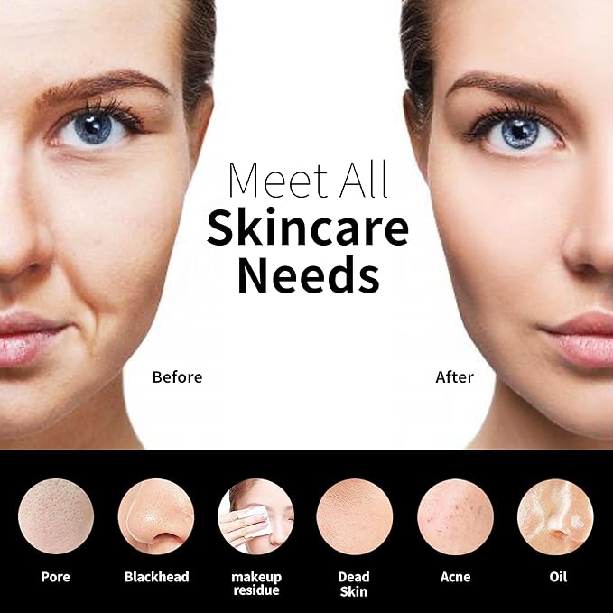 Silicone Face Scrubber, NågraCoola CLIE 2.0 Facial Cleansing Brush, Rechargeable, Waterproof Face Scrub Brush for Cleansing, Exfoliating, Massaging, Electric Facial Exfoliator for Women & Men - Black