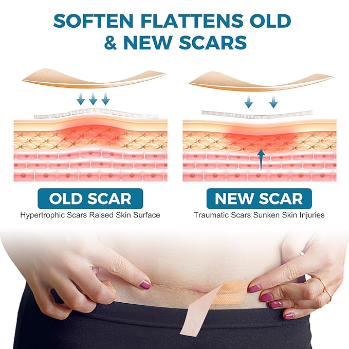 Scar Away Silicone Scar Sheets, Silicone