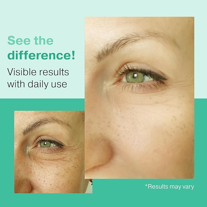 2X BIGGER 2OZ, Go Radiance 5% Glycolic Acid Serum, Salicylic Acid Serum for Acne-prone Skin, BHA Liquid Exfoliant, AHA Peel Lactic Acid Serum, Gentle Glycolic Acid Peel For Oil Control & Pore Reducer