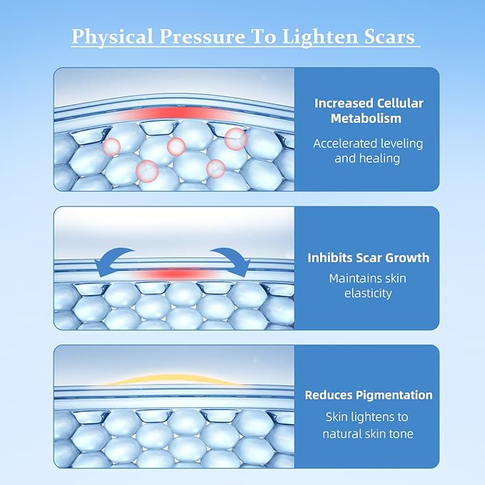 Silicone Scar Sheet, Silicone Scar Tape