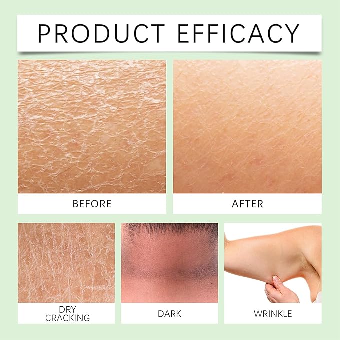 Body Lotion from Korea Whitening Remove Dark Spots, Original Niacinamide Whitening Body Lotion for Dry, Rough & Sensitive Skin, Moisturizing & Nourishing (1)