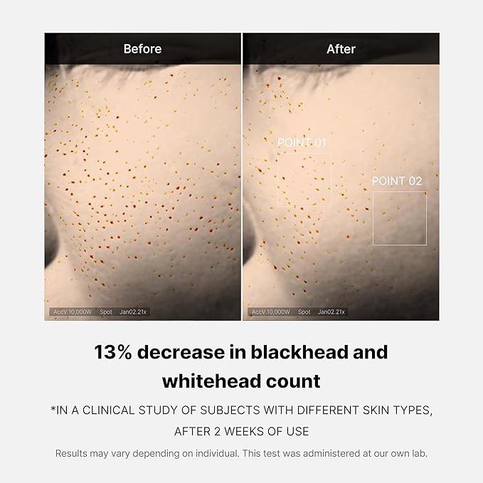 Medicube Zero Pore One-day Serum 1.01 fl.oz - Overnight Resurfacing Serum with Pore Tightening Complex - 15.2% AHA+BHA+PHA & 2% Niacinamide - 10.8% reduction in pore appearance after one day of use