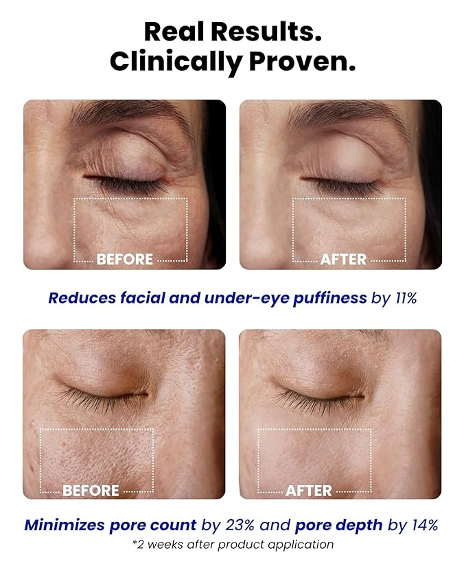 Ice Roll Serum | Cooling & Hydrating Roll-On Serum for Face, Puffy Eyes, Tannin & Panthenol for Pore Minimizing, Soothing, Facial Roller for Depuffing, Under Eye Bag Treatment | Korean Skin Care