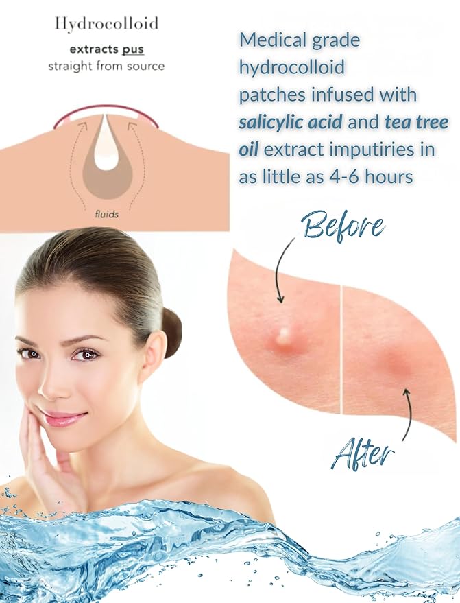 Acne Patch Ultra Thin Invisible Spot Cover- Fast Acting Hydrocolloid Pimple Patch with Salicylic Acid, Centella Asiatica & Tea Tree Oil- 72 Ct. Effective Treatment Absorbs Zits and Blemishes