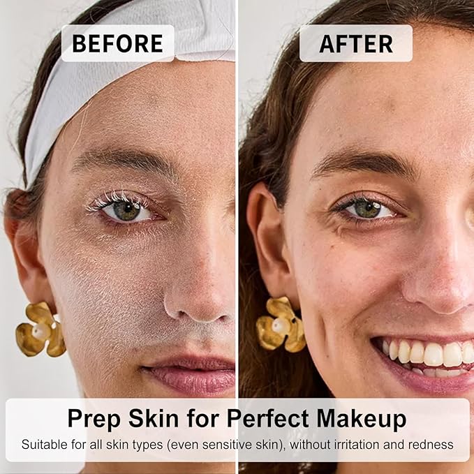 Face Razors for Women, Dermaplane Razor for Women Face, Eyebrow Razor, Facial Razors, Dermaplaning Tool, Gentle Skin Exfoliation Microblades for Sensitive Skin, Peach Fuzz Remover, 10 Count (Blush)