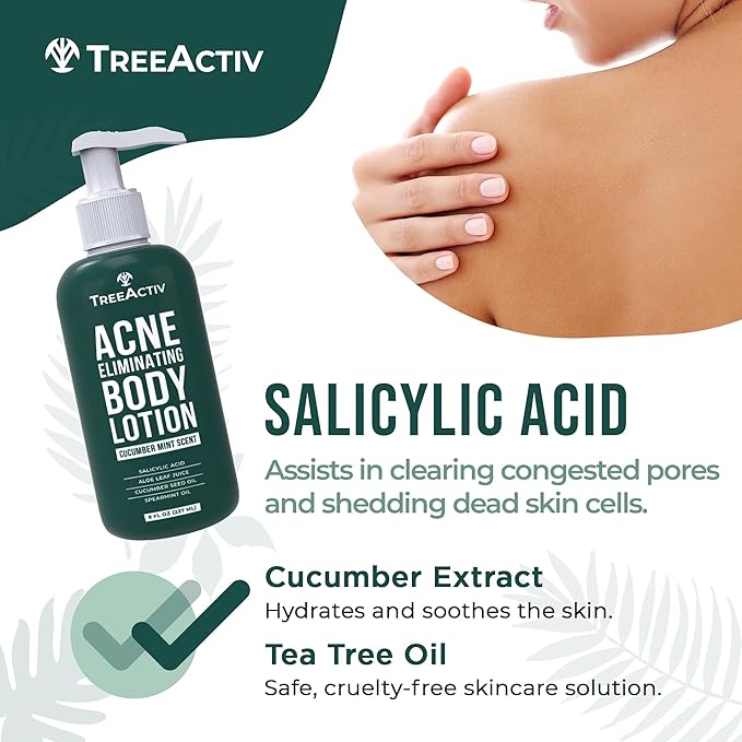 TreeActiv Acne Eliminating Body Lotion 8 fl oz | Clears Body, Back, Butt and Shoulder Acne | Anti-Acne Moisturizer | Prevents Future Breakouts | Cucumber Mint Scent
