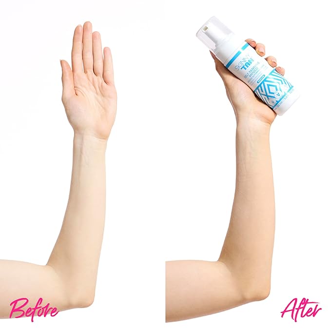 Skinny Tan Self-Tanning Mousse - Long-Lasting and Non-Drying Formula - Coconut and Vanilla Scent - Easy To Apply Luxurious, Foam Texture - Streak Free and Natural Looking Results - Medium - 5 oz