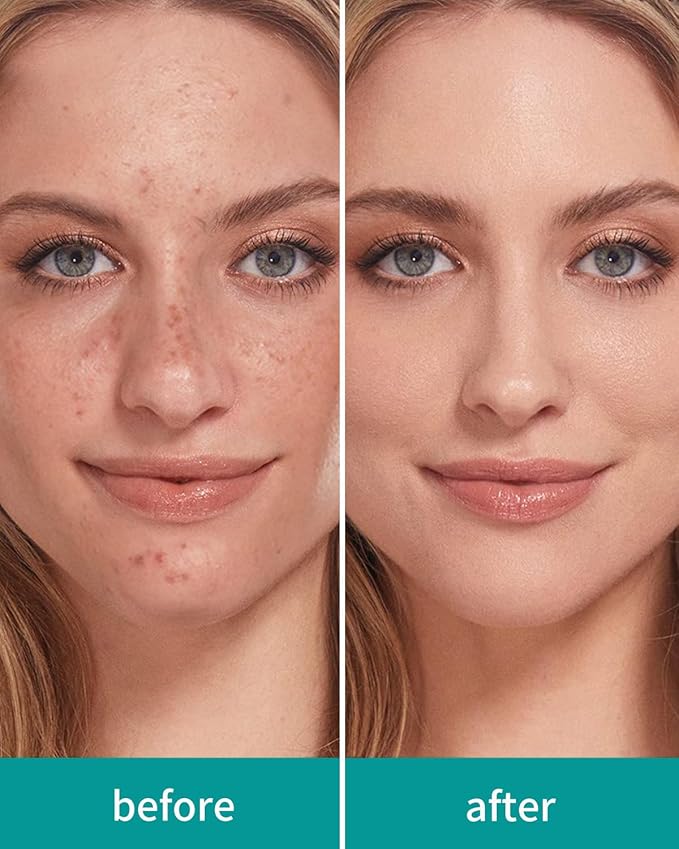 EIGSHOW Foundation and Concealer Brush, Dual Ended Makeup Brush For Flawless Foundation Coverage, Under Eye Concealer, Vegan & Cruelty-free (D110B)