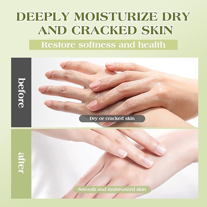 Beef Tallow For Skin – Natural Tallow and Honey Balm Face Moisturizer, Organic Grass-Fed Tallow, Deeply Nourishing Whipped Skin Balm for Face & Body, Moisturizing Cream for Dry Skin