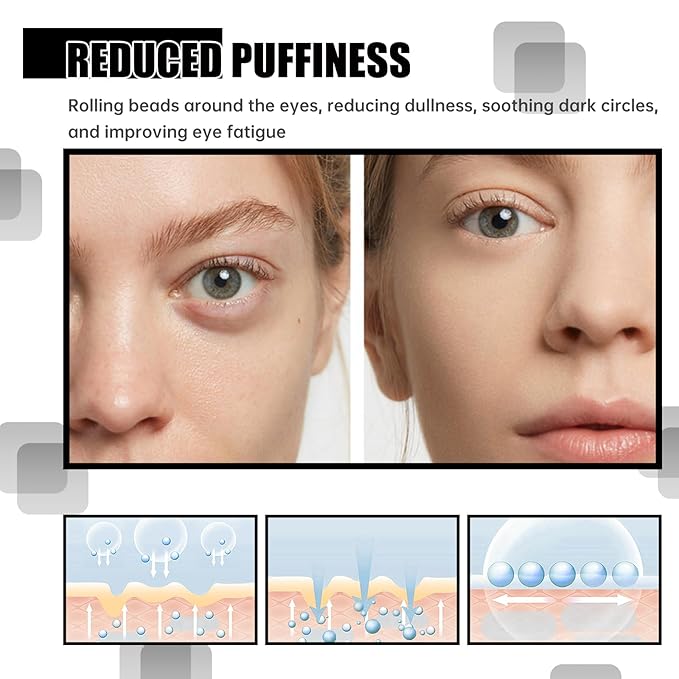 Time eraser roller ball castor