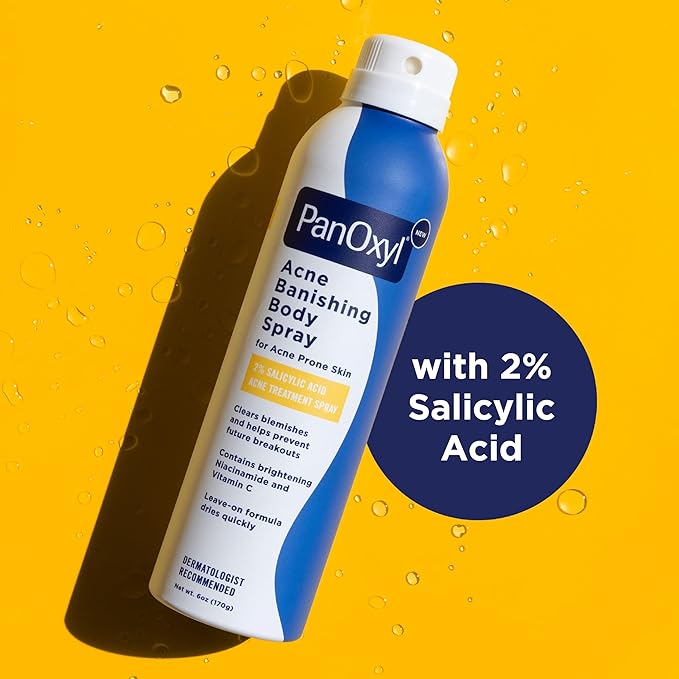 PanOxyl Acne Banishing Body Spray with 2% Salicylic Acid, Pimple Treatment Spray to Clear Stubborn Breakouts, 360-Degree Spray Nozzle, Skin-Brightening Niacinamide, Vitamin C, Witch Hazel, Aloe, 6 Oz