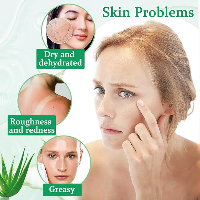 8PCS Aloe Vera Gel for Face & Skin,Organic Aloe Vera Gel,Hydrating After Sun Cream for Travel Size,Moisturizing Lotion for Skincare,After Sun Lotion for All Skin Type(H)