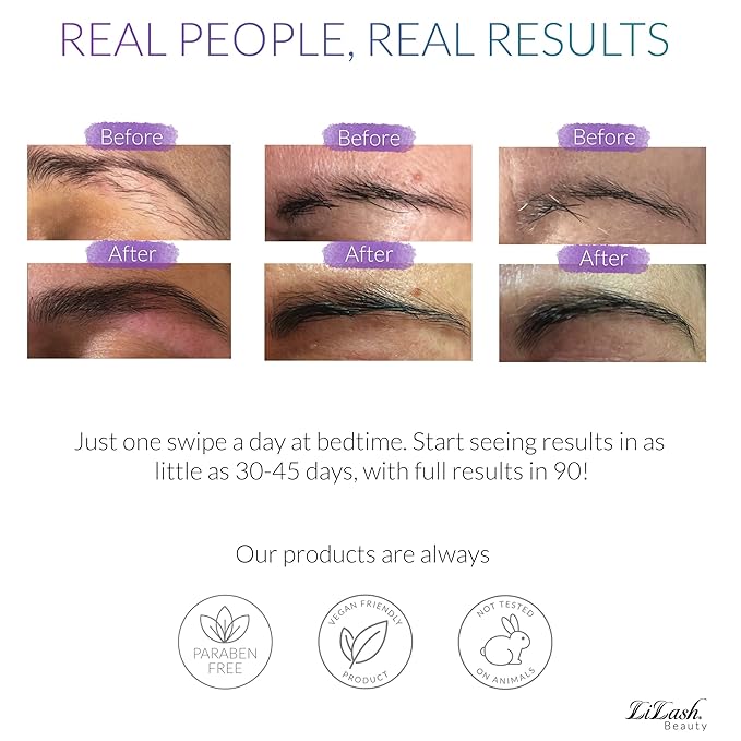 LiBrow® Purified Eyebrow Physician-Formulated Serum XL for Fuller & Thicker Looking Eyebrows | Natural Eyebrow Enhancer Safe for Sensitive Skin | 6-Month Supply (6ml)