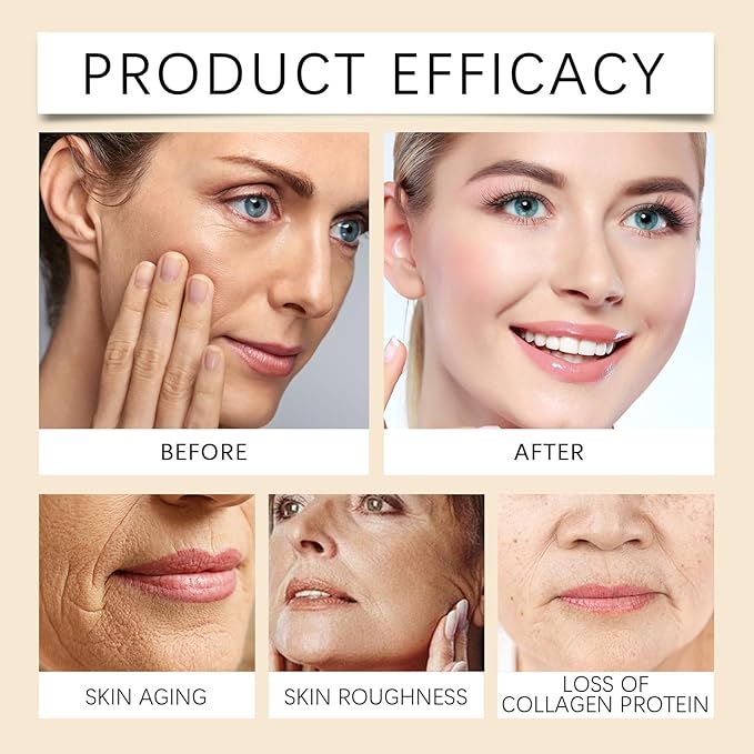 2 Pcs Bee Venom Skin Cream, Anti-Aging Face for All Skin Type Wrinkle Removal & Firming Moisturiser Cream